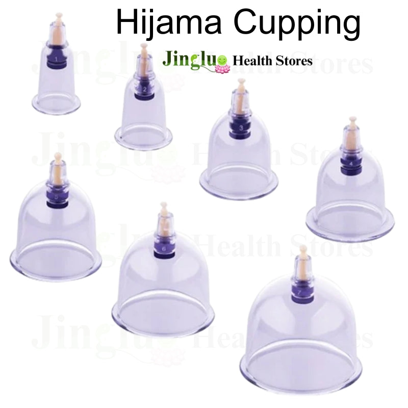 Hijama Cupping